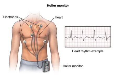 holter-schemat-1698871042.jpg